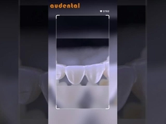 HT Blanco 16 colores líquidos Bloque de zircónia dental con paquete de caja de carbono