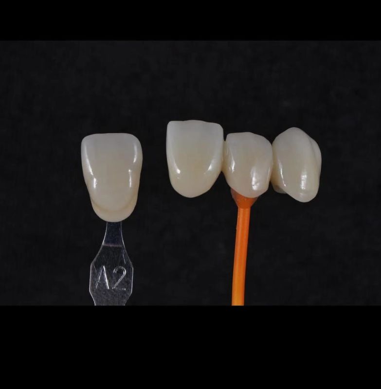 3D Pro Zirconia Dental Blanco CAD CAM Bloque 98/95/92mm Sistema abierto CE
