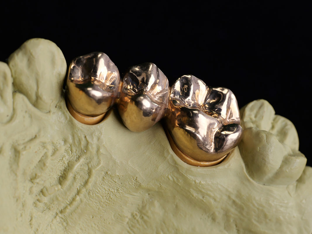Audental A75 (Alta NOBL /Crown&Bridge Alloy /amarillo/Au75%)