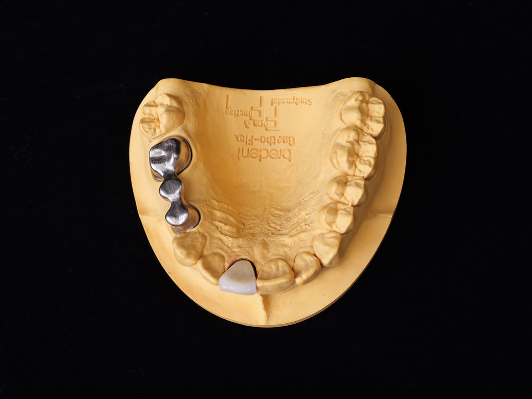 Audental 04 aleación noble de plata-paládio porcelana aleación blanca Pd53.3% para restauraciones dentales de larga duración