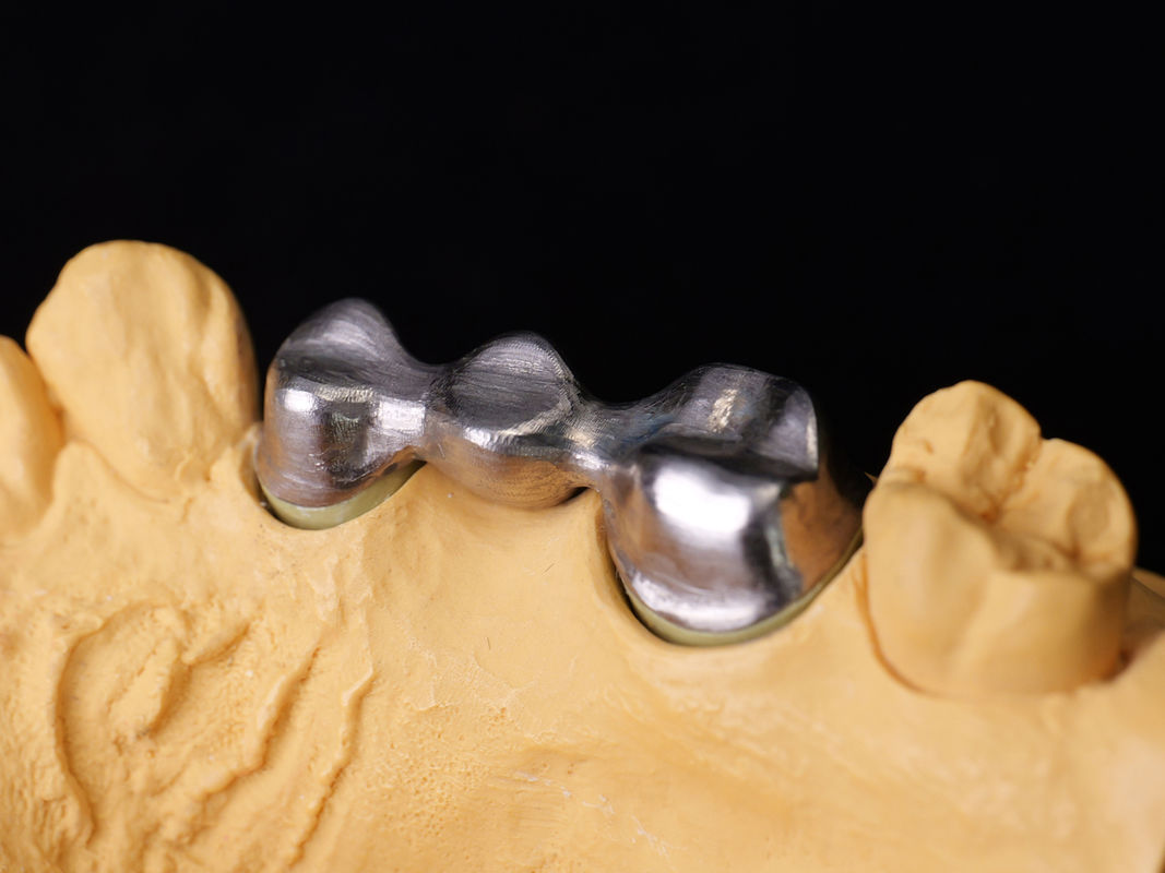 Audental 04 aleación noble de plata-paládio porcelana aleación blanca Pd53.3% para restauraciones dentales de larga duración