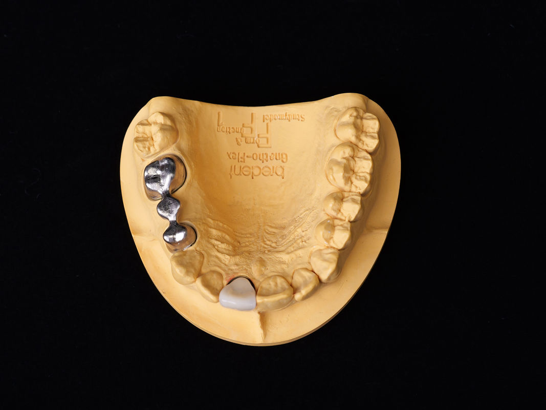 Audental 43 aleación de porcelana de plata y paladio Pd43% noble para restauraciones dentales fuertes y estéticas