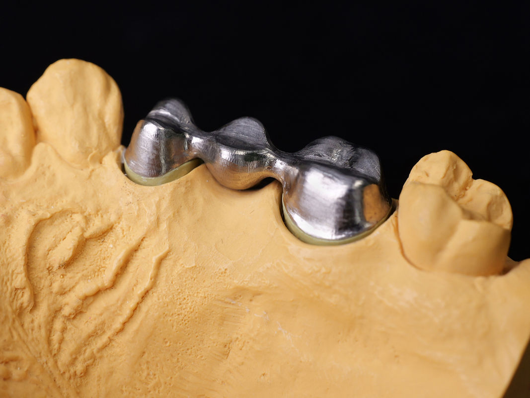 Audental 43 aleación de porcelana de plata y paladio Pd43% noble para restauraciones dentales fuertes y estéticas