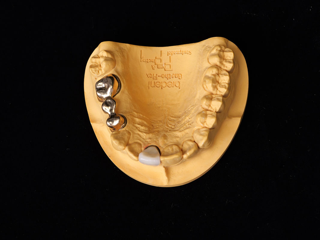 Audental 90 Restauración dental Alta aleación noble, aleación de cerámica dental amarillo Au89.5%