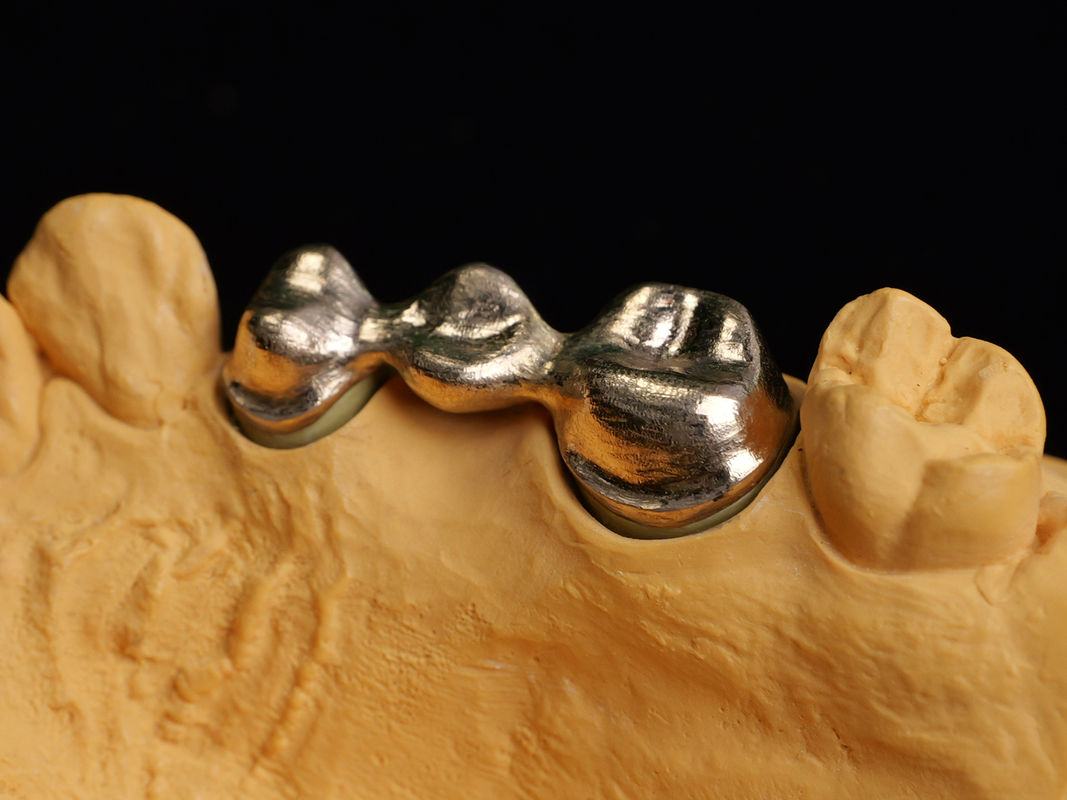 Audental 90 Restauración dental Alta aleación noble, aleación de cerámica dental amarillo Au89.5%