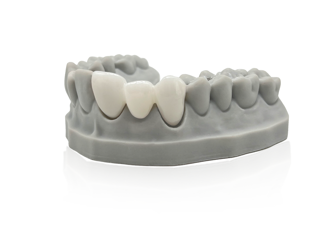 Dental Zirconia Block optimized for anterior restorations with natural esthetic layering and compatibility with CAD CAM dental systems