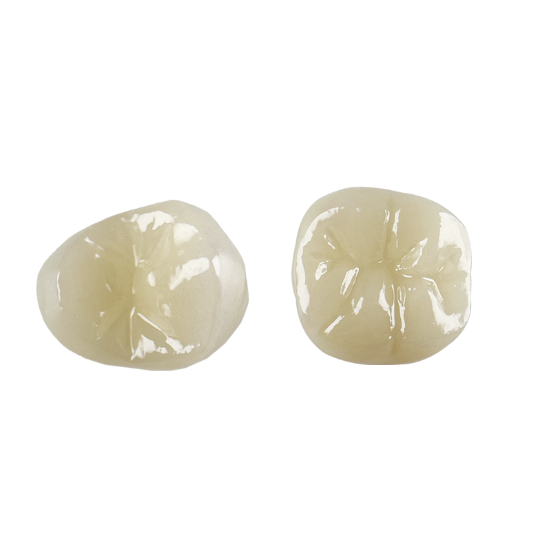 Cerámica de vidrio dental diseñada para una consistencia y un rendimiento precisos en las carillas, las coronas, las incrustaciones, las incrustaciones y los puentes anteriores